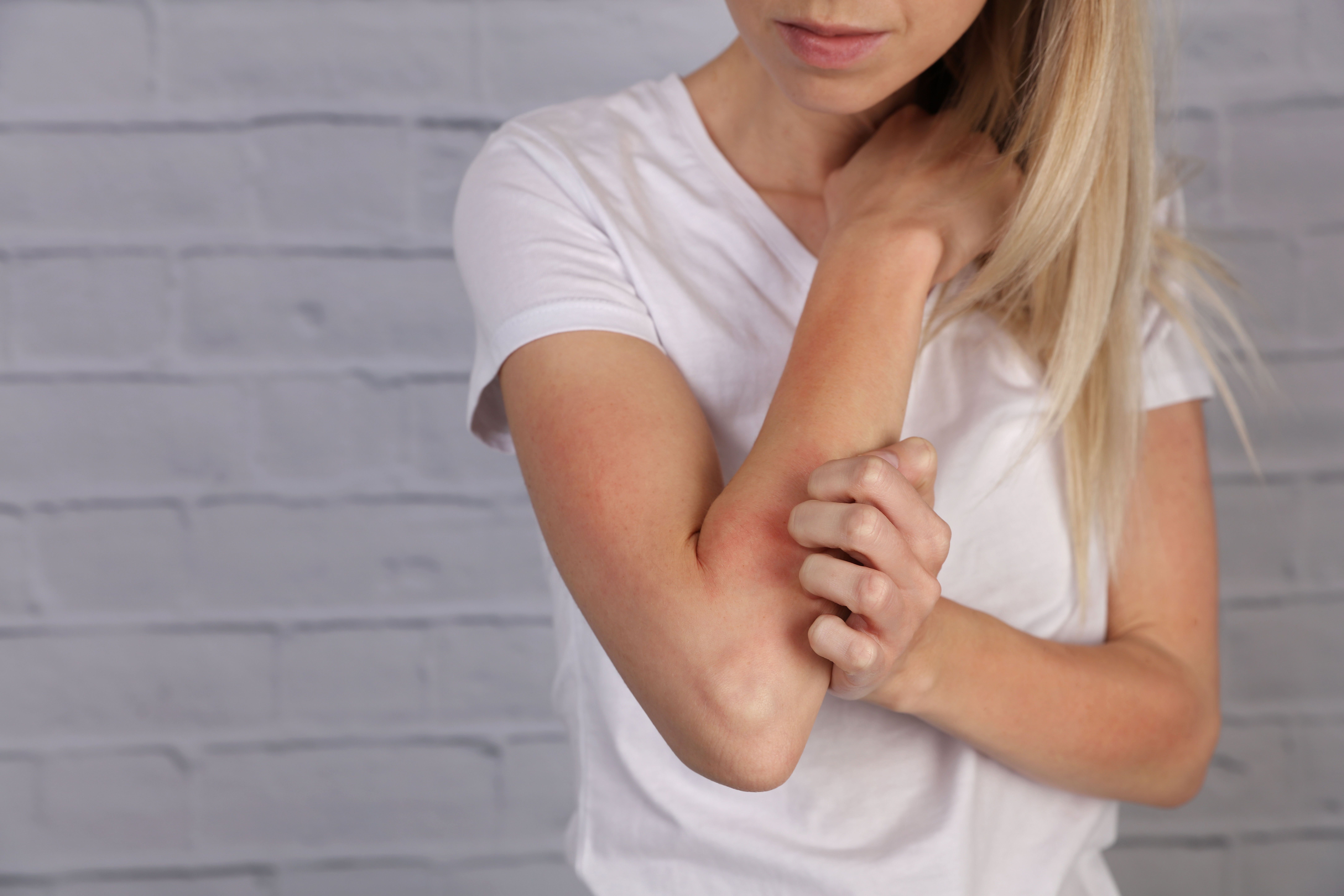 Identification and Common Cause of Skin Rashes | The Derm Collective North Shore